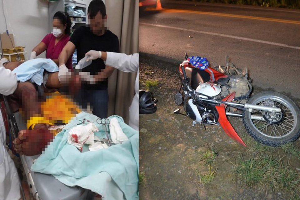  Motociclista tem perna decepada em acidente na BR 364