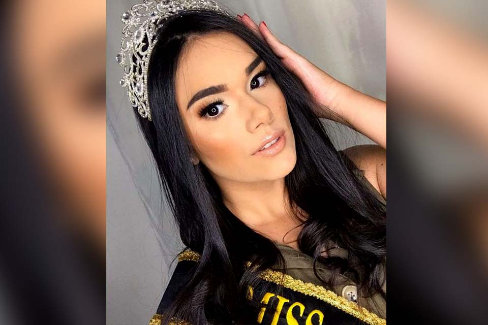 Miss morre aos 21 anos após cirurgia em Roraima