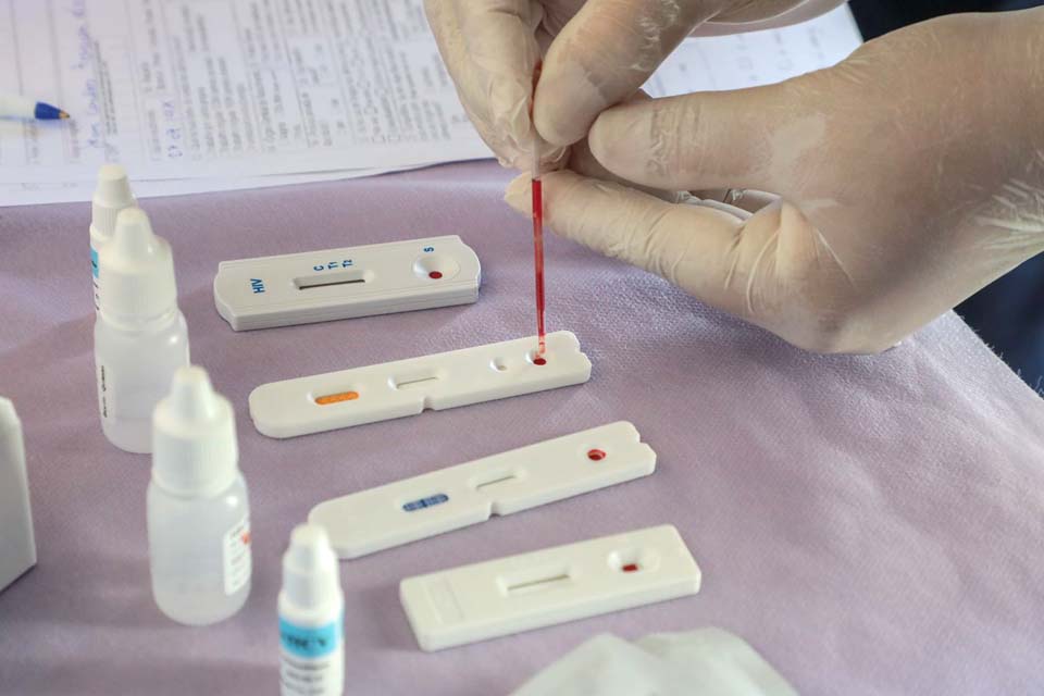 Saúde orienta farmácias sobre testes para HIV, sífilis e hepatites