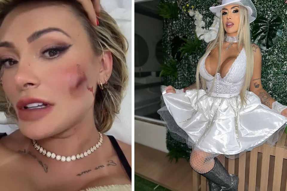 Andressa Urach é ferida com taça em briga com Juju Ferrari e leva pontos no rosto