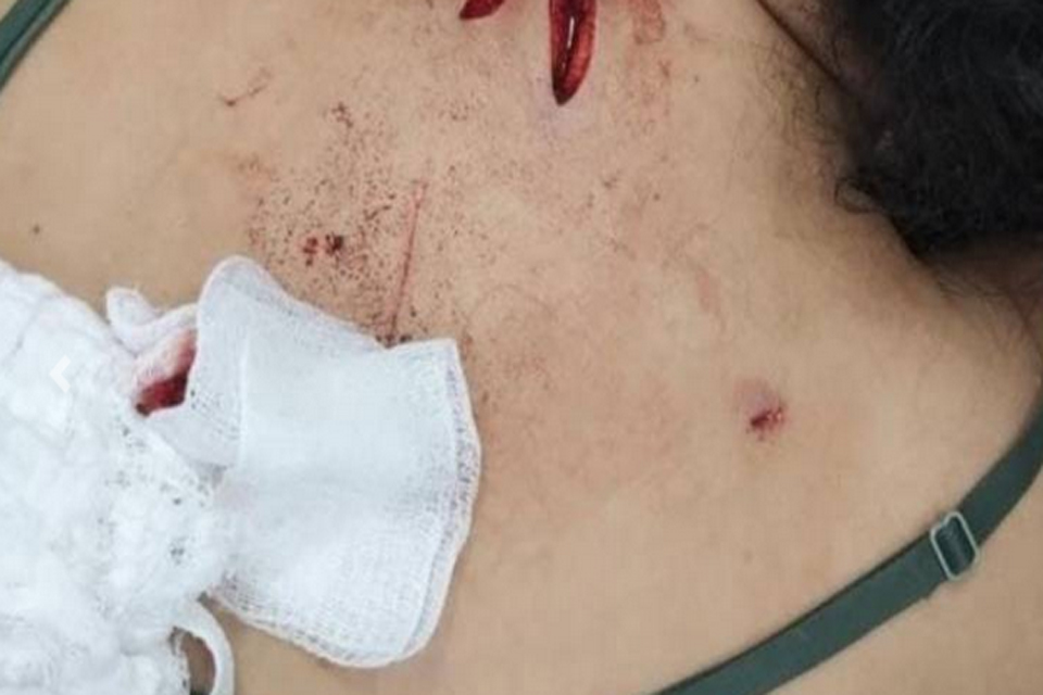 Briga termina com mulher ferida a golpes de faca pela própria filha