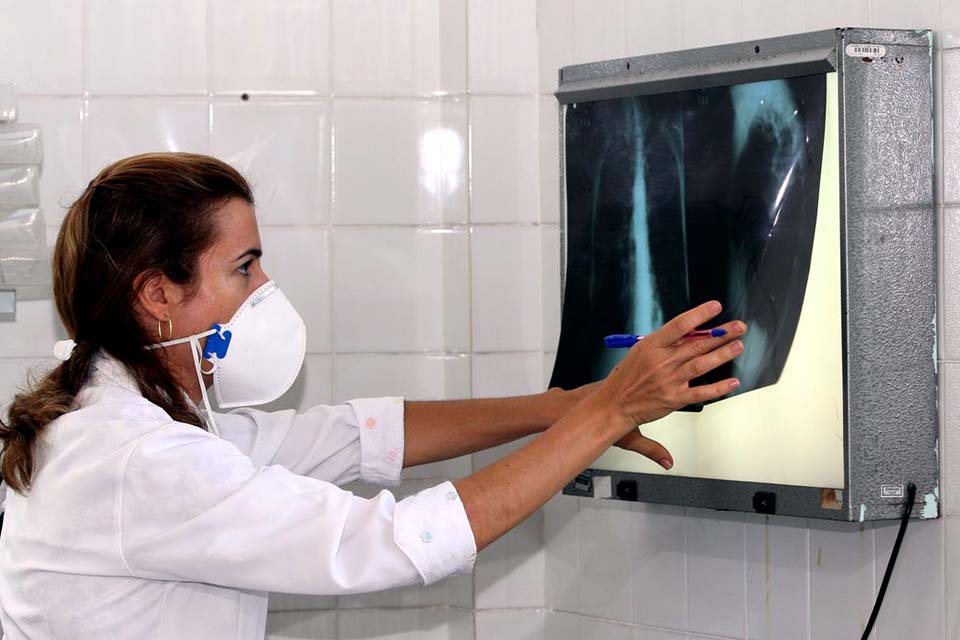 Tuberculose: medicamento para tratamento mais curto está sob consulta