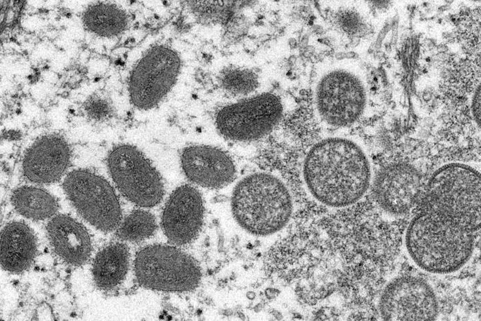 Equador detecta primeiro caso de varíola dos macacos