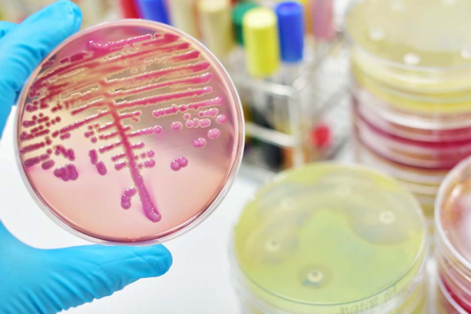 E. coli outbreak in UK leaves one dead;  There are 275 confirmed cases  general