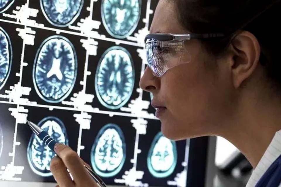 Cientistas podem ter desvendado enigma de como Alzheimer 'mata' neurônios