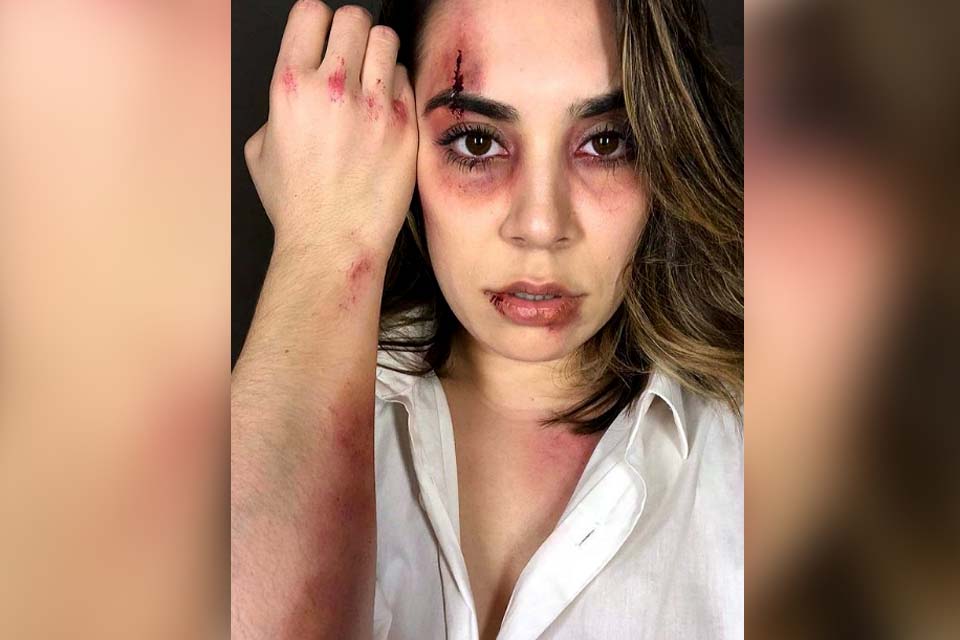 Naiara Azevedo é criticada após publicar foto 'machucada' em post sobre violência doméstica