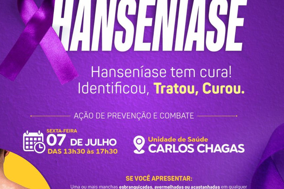 Secretaria de Saúde promoverá ação de prevenção e combate a Hanseníase no dia 7 de julho  