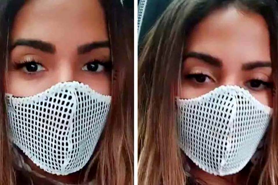 Após trombose, Anitta recebe alta do hospital: “Estou livre”