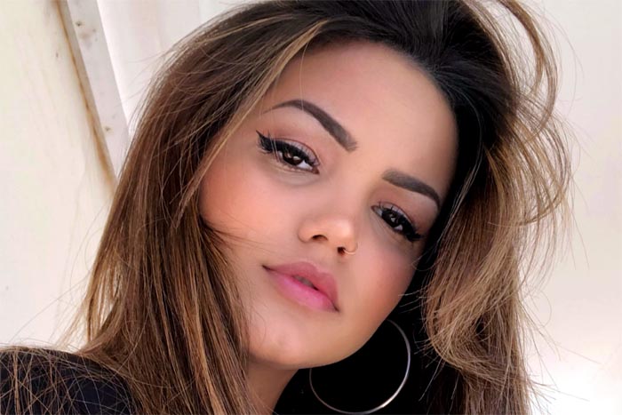 Filha de Kelly Key, Suzanna assume botox aos 18 anos em foto de antes e depois