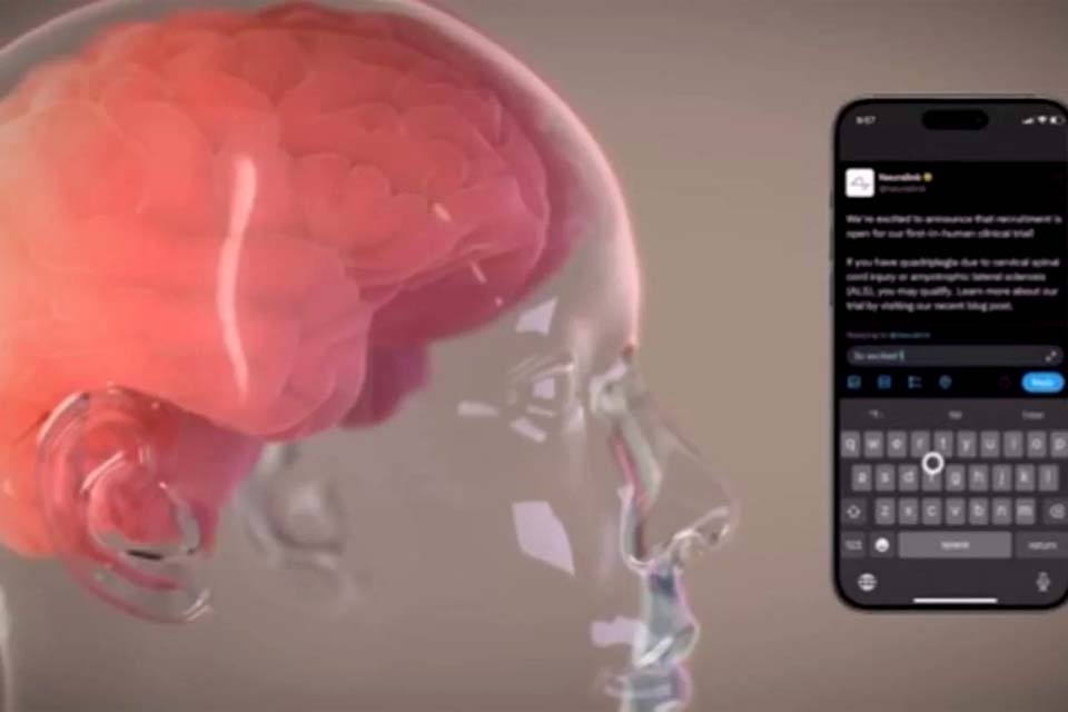 Neuralink, de Elon Musk, anuncia 1º implante de chip em cérebro humano