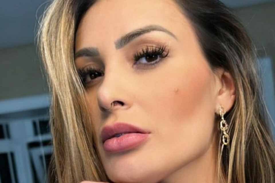 Andressa Urach mostra recuperação dolorosa após bifurcação da língua: “Não posso escovar os dentes”