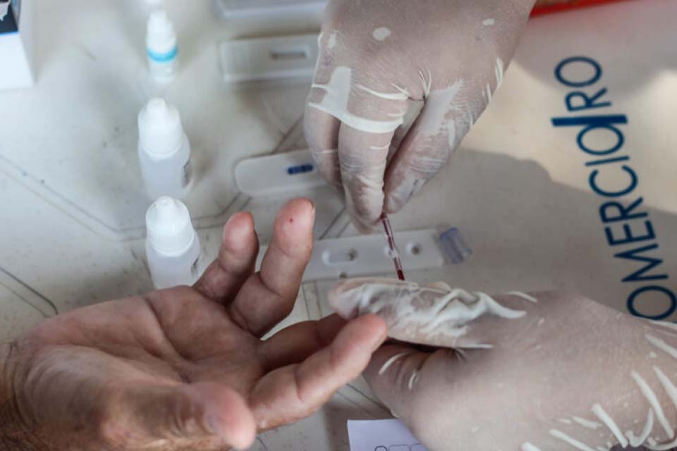 Testes e tratamento antirretroviral são disponibilizados na rede estadual de saúde