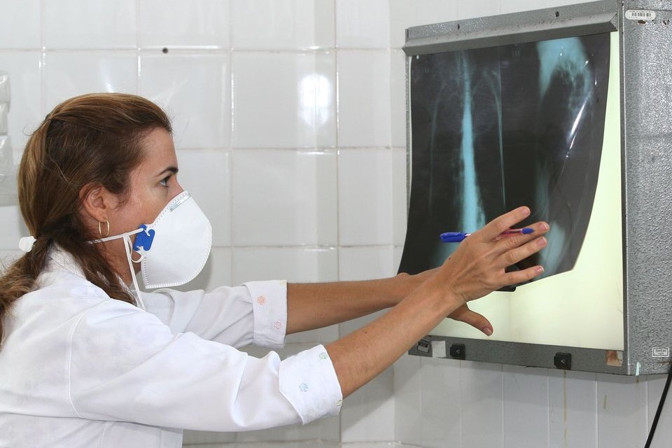 OMS: tratamento da tuberculose não deve ser descuidado